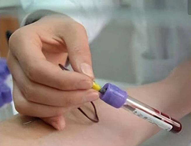 国内有正规的供卵试管代怀_国内正规供卵试管代怀中心