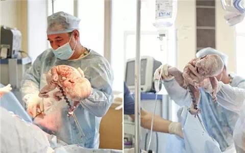 国内代生孩子公司-国内代生孩子公司：孕育新生命的专业服务