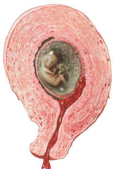 国内借卵试管代怀男孩过程(国内借卵试管代怀男孩全过程)